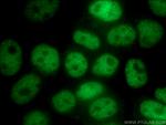 UBR5 Antibody in Immunocytochemistry (ICC/IF)