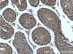 UBR5 Antibody in Immunohistochemistry (Paraffin) (IHC (P))