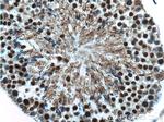 UBR5 Antibody in Immunohistochemistry (Paraffin) (IHC (P))