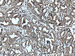 MCT4 Antibody in Immunohistochemistry (Paraffin) (IHC (P))