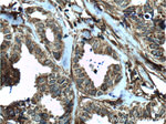 MCT4 Antibody in Immunohistochemistry (Paraffin) (IHC (P))