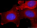 MCT4 Antibody in Immunocytochemistry (ICC/IF)