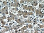 PHLPP Antibody in Immunohistochemistry (Paraffin) (IHC (P))