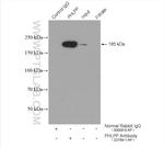 PHLPP Antibody in Immunoprecipitation (IP)