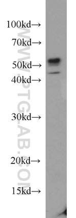 SPAST Antibody in Western Blot (WB)