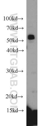 SPAST Antibody in Western Blot (WB)