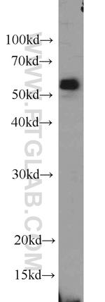 SPAST Antibody in Western Blot (WB)