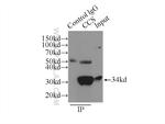 CCS Antibody in Immunoprecipitation (IP)