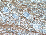 IGF2BP1 Antibody in Immunohistochemistry (Paraffin) (IHC (P))