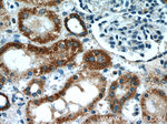 IGF2BP1 Antibody in Immunohistochemistry (Paraffin) (IHC (P))