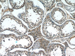 IGF2BP1 Antibody in Immunohistochemistry (Paraffin) (IHC (P))