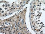 IGF2BP1 Antibody in Immunohistochemistry (Paraffin) (IHC (P))