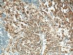 IGF2BP1 Antibody in Immunohistochemistry (Paraffin) (IHC (P))