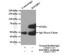 IGF2BP1 Antibody in Immunoprecipitation (IP)