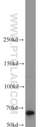 IGF2BP1 Antibody in Western Blot (WB)