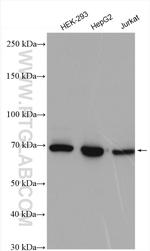 IGF2BP1 Antibody in Western Blot (WB)