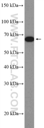 IGF2BP1 Antibody in Western Blot (WB)