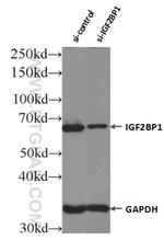 IGF2BP1 Antibody in Western Blot (WB)