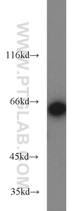 IGF2BP1 Antibody in Western Blot (WB)