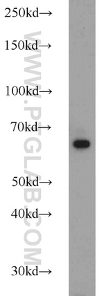 IGF2BP1 Antibody in Western Blot (WB)