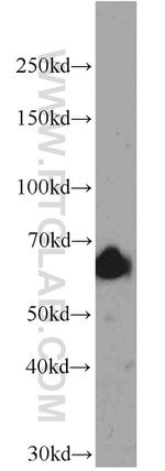 IGF2BP1 Antibody in Western Blot (WB)