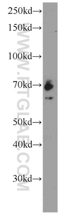 IGF2BP1 Antibody in Western Blot (WB)