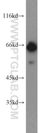 IGF2BP1 Antibody in Western Blot (WB)