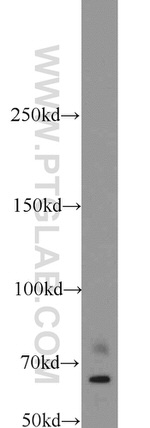 IGF2BP1 Antibody in Western Blot (WB)