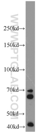 IGF2BP1 Antibody in Western Blot (WB)