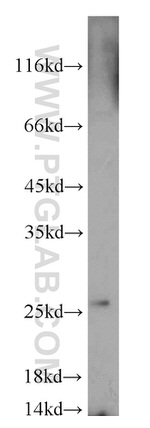 C7orf30 Antibody in Western Blot (WB)