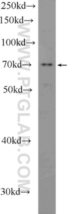 NO66/C14orf169 Antibody in Western Blot (WB)