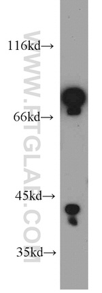 OFD1 Antibody in Western Blot (WB)