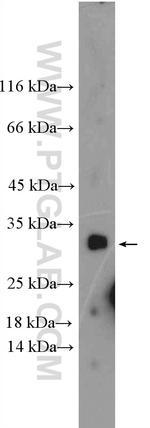 IL31 Antibody in Western Blot (WB)