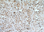 IL22RA2 Antibody in Immunohistochemistry (Paraffin) (IHC (P))