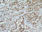 IL22RA2 Antibody in Immunohistochemistry (Paraffin) (IHC (P))