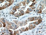 IL22RA2 Antibody in Immunohistochemistry (Paraffin) (IHC (P))