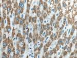 ACSM2A Antibody in Immunohistochemistry (Paraffin) (IHC (P))