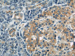 CSAD Antibody in Immunohistochemistry (Paraffin) (IHC (P))