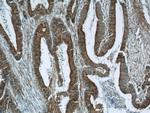 B3GNT7 Antibody in Immunohistochemistry (Paraffin) (IHC (P))