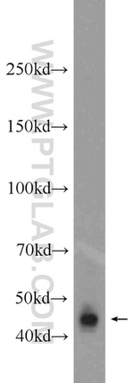 B3GNT7 Antibody in Western Blot (WB)