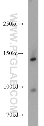 MYBPC1 Antibody in Western Blot (WB)