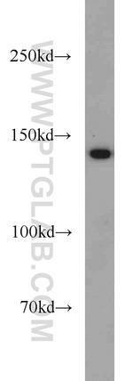 MYBPC1 Antibody in Western Blot (WB)