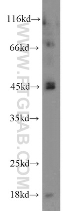 Caspase 1/p20/p10 Antibody in Western Blot (WB)