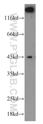 Caspase 1/p20/p10 Antibody in Western Blot (WB)