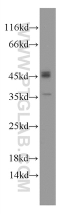 Caspase 1/p20/p10 Antibody in Western Blot (WB)