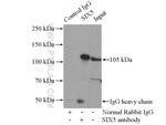 SIX5 Antibody in Immunoprecipitation (IP)