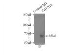 ZBTB10 Antibody in Immunoprecipitation (IP)