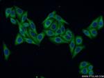 Osteopontin Antibody in Immunocytochemistry (ICC/IF)