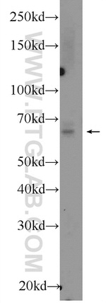 Osteopontin Antibody in Western Blot (WB)