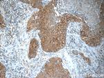 MMP12 Antibody in Immunohistochemistry (Paraffin) (IHC (P))